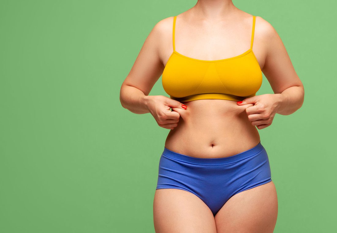 Abdominoplastie