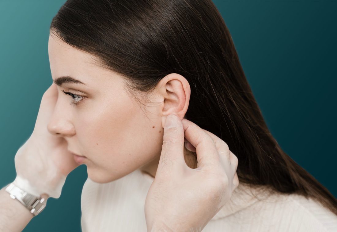 Otoplastie | Clinique XANADU Lyon